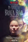 My Beautiful Broken Brain My Beautiful Broken Brain.2016 字幕下载