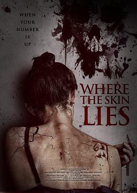 皮附 Where the Skin Lies.2017 字幕下载