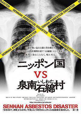 日本国vs泉南石棉村 ニッポン国泉南石綿村 劇場版 命て なんぼなん？.2016 字幕下载